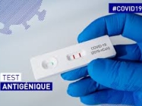 Du 21 au 31 décembre 2020 : Opération de dépistage rapide avec des tests antigeniques à Châtenoy le Royal